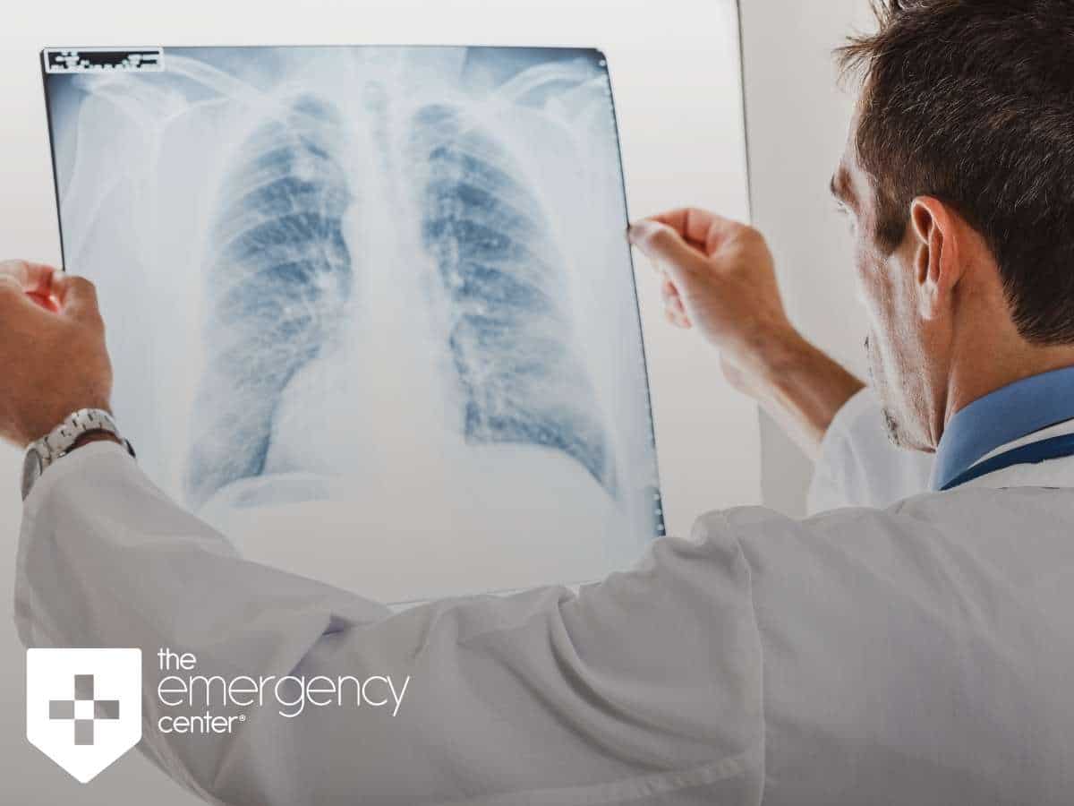 ER physician Analyzing X-ray for Pulmonary Embolism